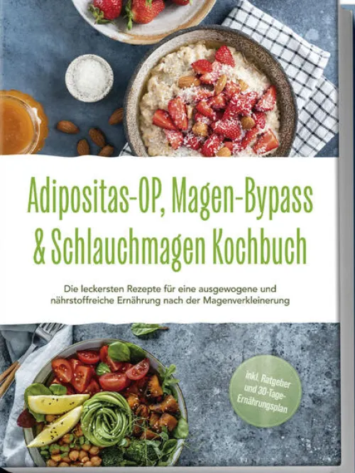 Adipositas-OP, Magen-Bypass & Schlauchmagen Kochbuch: Die leckersten Rezepte für eine ausgewogene und nährstoffreiche Ernährung nach der Magenverkleinerung - inkl. Ratgeber und 30-Tage-Ernährungsplan*Edition Lunerion Online