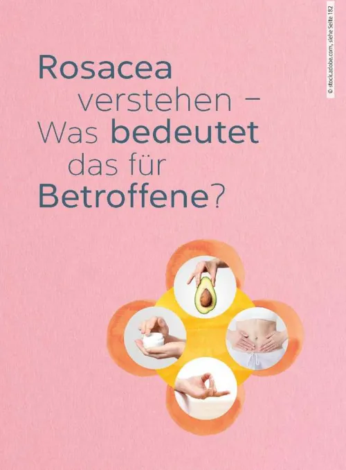 Rosacea*Trias Best